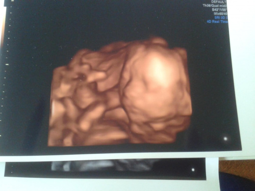 7e6d422cb2619e83med.jpg